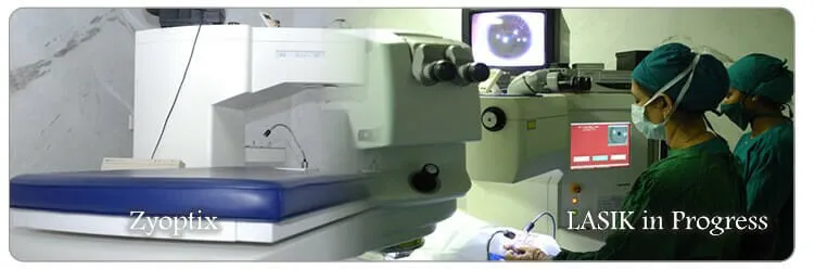 LASIK & SMILE Eye Surgery with Zyptoxis Technology lasik- eye-surgery- zyptoxis